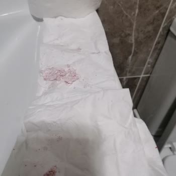 Selpak Tuvalet Kağıdı Şikayeti