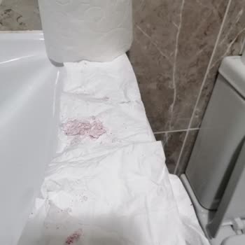 Selpak Tuvalet Kağıdı Şikayeti