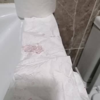 Selpak Tuvalet Kağıdı Şikayeti