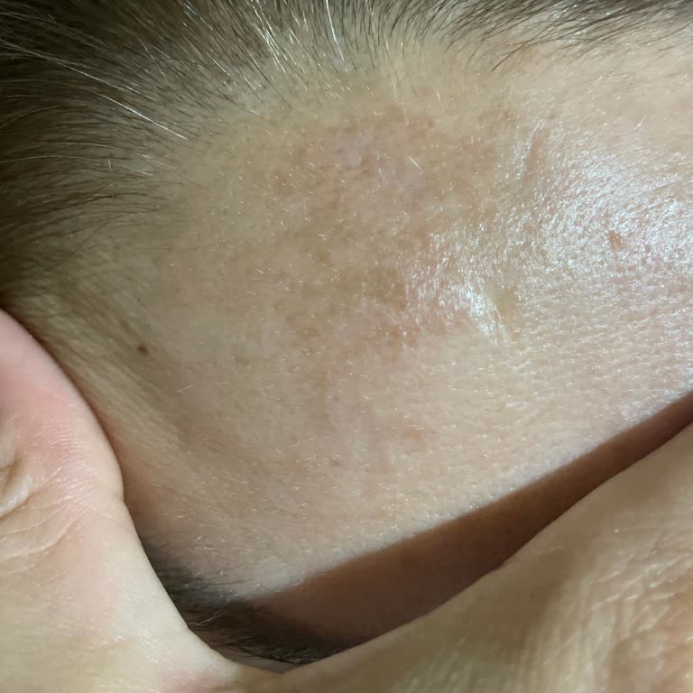 Aris Üsküdar'da Kaş Kontörü Ve Cilt Bakımı Kabusu