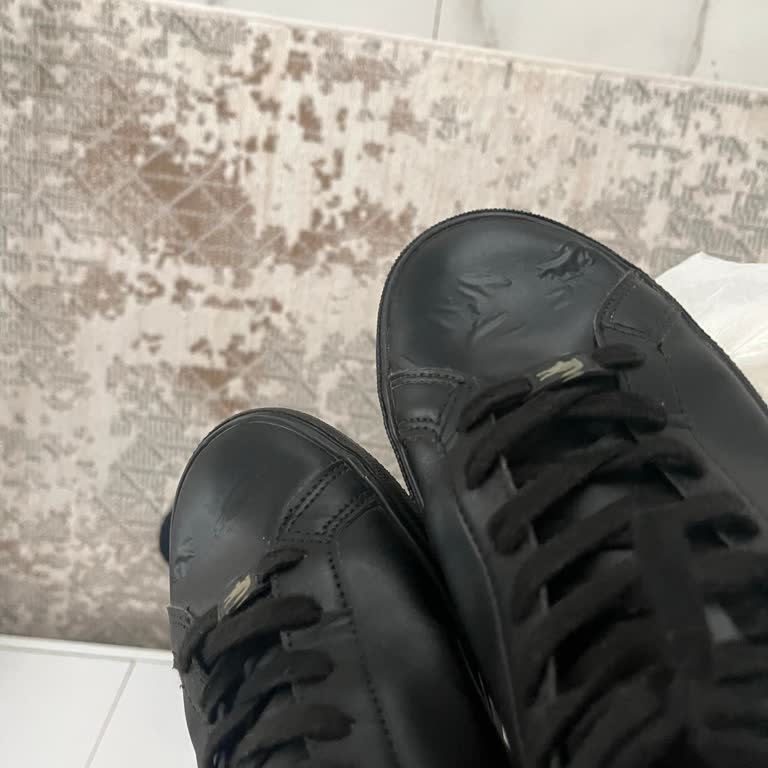 2 Ay İçerisinde Derisi Şişen Lacoste Ayakkabı