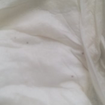 Migros Tan Aldığım Sleepy Ecologic Bebek Bezinde Siyah Maddeler Var