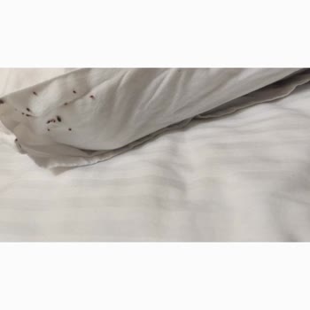 Taş Saray Bardakçı Hotel'de Gece Tahta Kurusu Saldırısına Uğradım!
