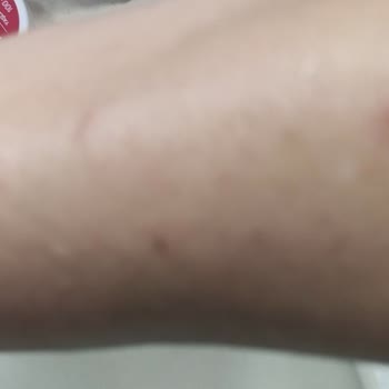 Taş Saray Bardakçı Hotel'de Gece Tahta Kurusu Saldırısına Uğradım!