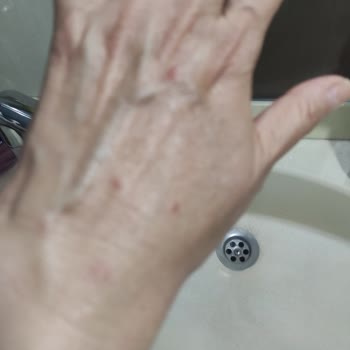 Taş Saray Bardakçı Hotel'de Gece Tahta Kurusu Saldırısına Uğradım!