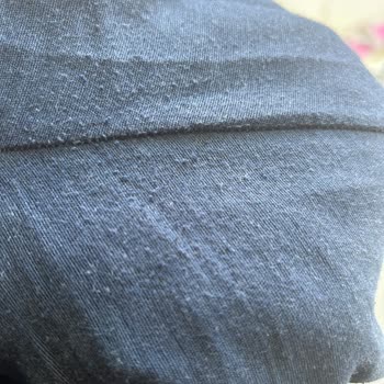 Öykü Fashion 1 Haftada Tüylenen Ve Küçülen Ürün