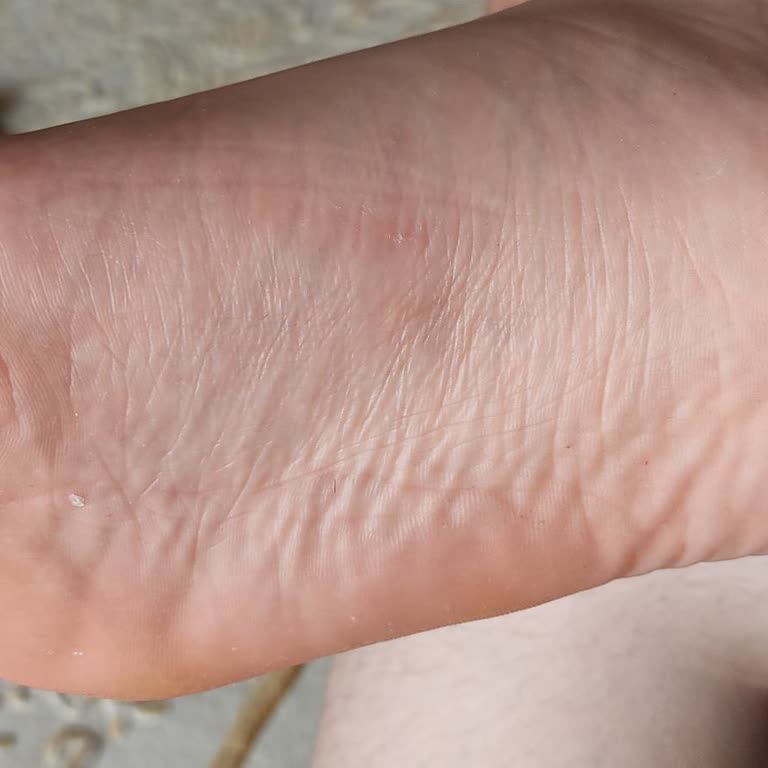 Boyner'den Aldığımız Adidas Ayakkabı 1 Ayda Çocuğumun Ayağını Yaraladı!