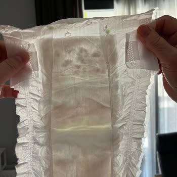 Sleepy Yenidoğan Bez Sızdırması