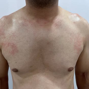 Veet Tüy Dökücü Krem