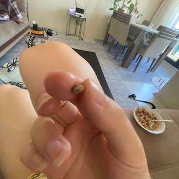 Dardanel Tondan Taş Çıktı