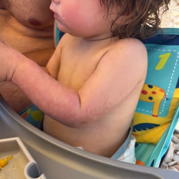 İncia Bebek Güneş Kremi Kızımın Cildini Mahvetti