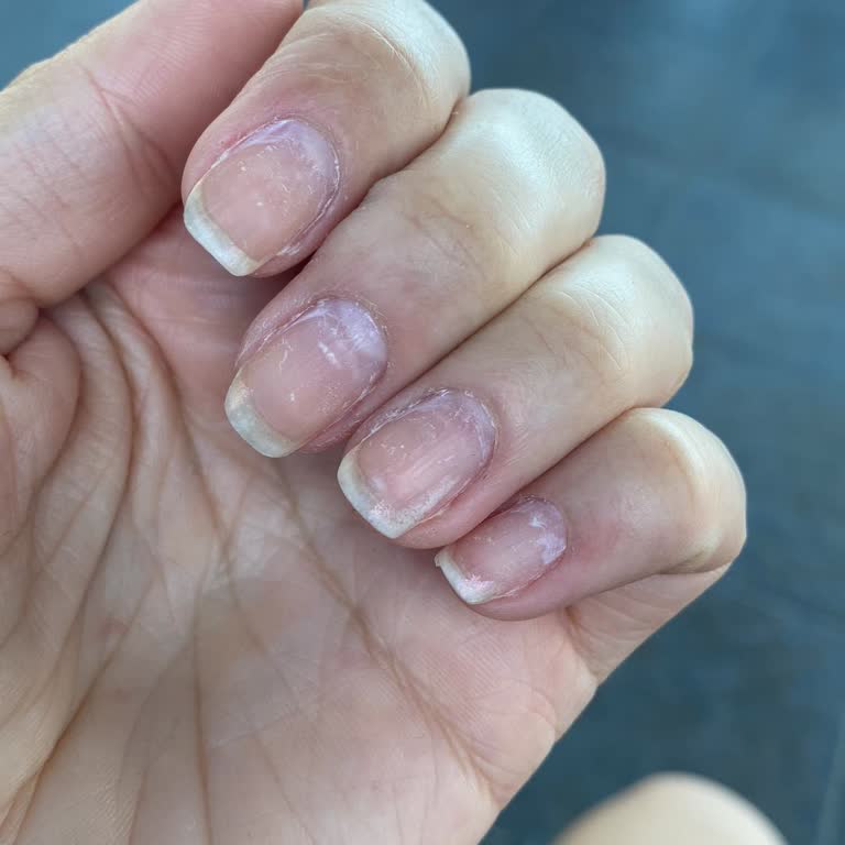 Olga Tırnak Center Olumsuz Deneyim