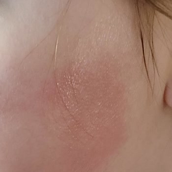 Nivea Güneş Kremi Şikayeti