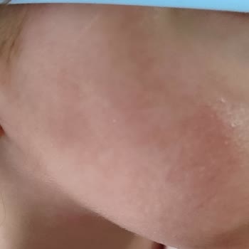 Nivea Güneş Kremi Şikayeti