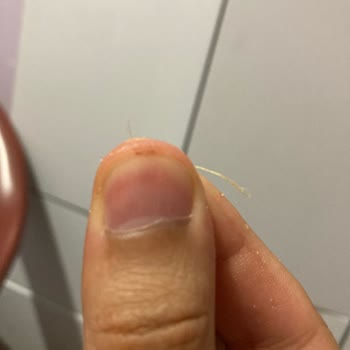 Amigo Şok Marketten Aldığım Cipsten Plastik Parçalar Çıktı