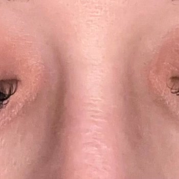 Aymira Koçaklı Yaşam Merkezi Konak Şube İpek Kirpik Şikayet