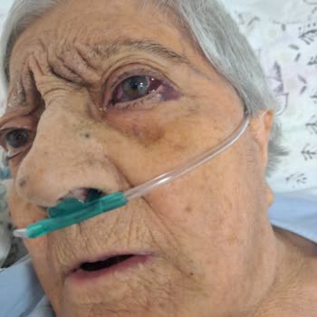 Ankara Atatürk Sanatoryum Hastanesi Kronik Astım Hastası Annem İçin Yetersiz Bakım Ve İlgisizlik