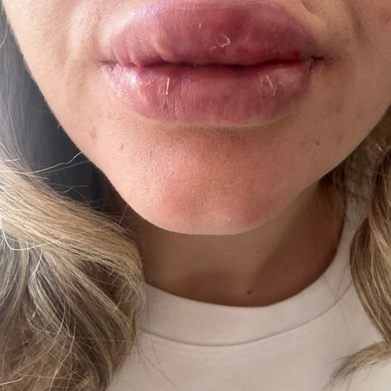 Lavinya Golden Ankara Sağlık Ve Hijyen Konusunda Yetersiz Hizmet