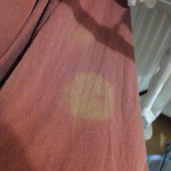 Kosla Vanish Oxi Leke Çıkarıcı Mağduriyeti