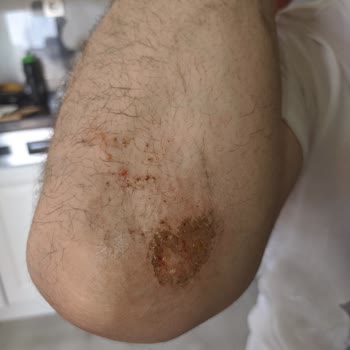BinBin'le Giderken Gidon Koptu