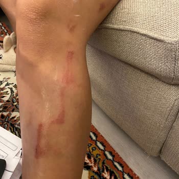 His Estetik ve Güzellik Merkezi (Körfez) His Estetik Mağduriyeti