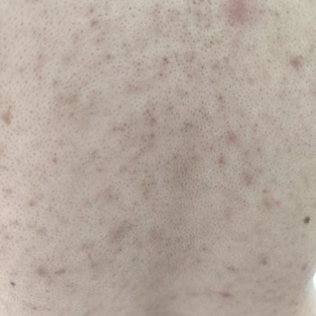 Enza Güzellik Merkezleri Kayseri Hayal Kırıklığı Kötü Hizmet Ve Alerji Sorunu
