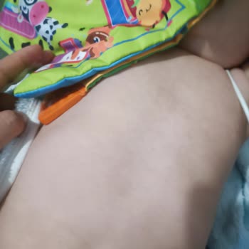 Mustela Bebeğimde Alerji Yaptı!