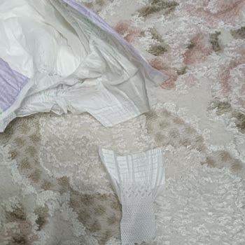 Evy Baby Çocuğum Çok Kötü Pişik Oldu Şu An Çok Zor Durumdayım...