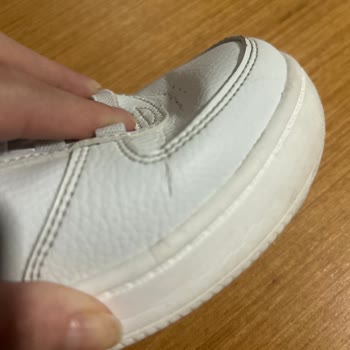 Hepsiburada Skechers Ayakkabı Deforme Oldu