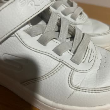 Hepsiburada Skechers Ayakkabı Deforme Oldu