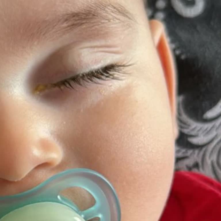 Mustela Bebek Şampuanı Çapaklanma Sorunu