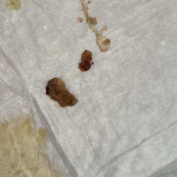 Pet Kuaför Sezer Balcı Köpeklerim Enfeksiyon Kaptı