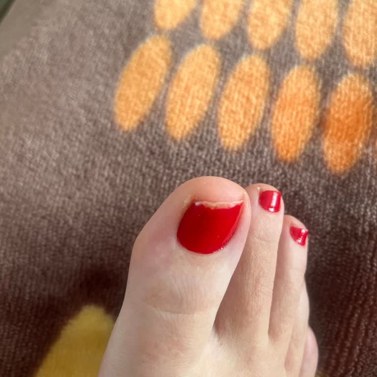 Puma-Sportschuhe falsche Größenangabe führt zu Schmerzen und Beschwerden