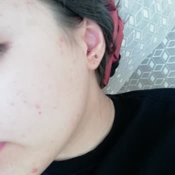 The Purest Solutions Yüzümü Mahveden Güneş Kremi