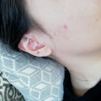 The Purest Solutions Yüzümü Mahveden Güneş Kremi