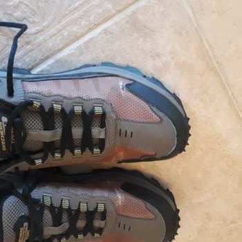 Skechers Ayakkabıları 6 Ayda Yırtılıyor, Kullanıcı Hatası Deniliyor.