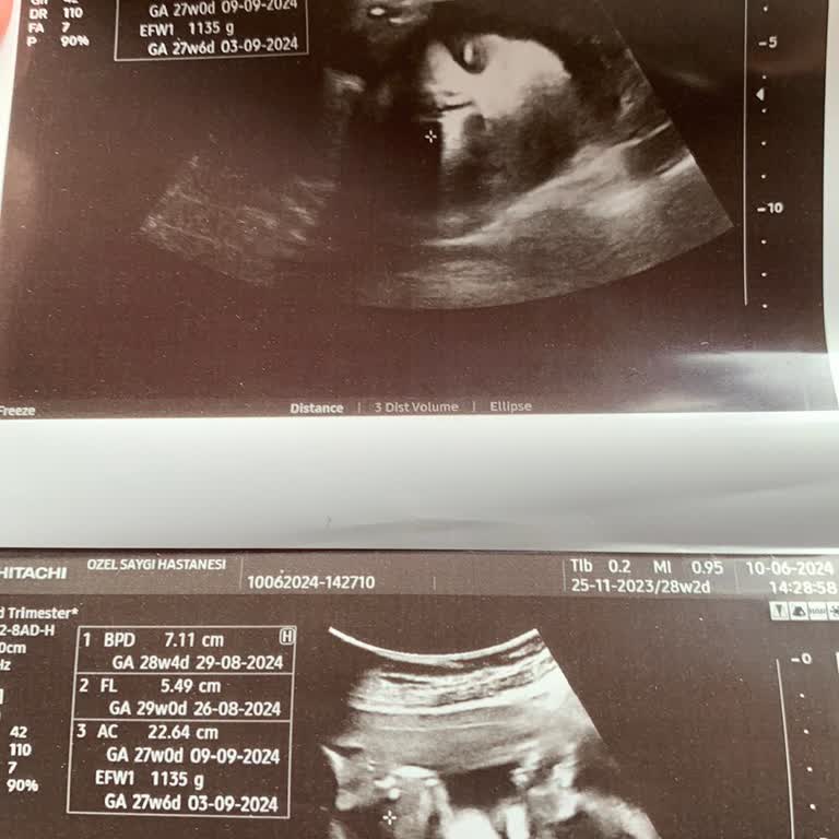 Saygı Hastanesi Kadım Doğum Bölümü İlgisizlik