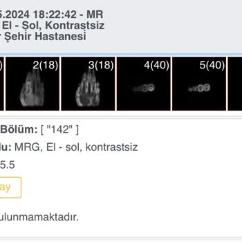 İzmir Şehir Hastanesi MR Sonucunu 1 Aydır Açıklamıyor