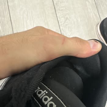 Adidas Ayakkabı Boyasının Akması Topuğa Vurması