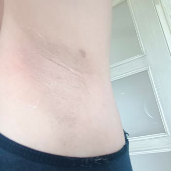 ESS Güzellik Merkezi Mağduriyet