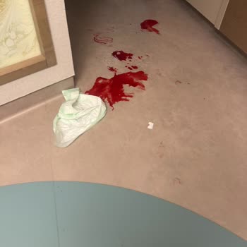 Acıbadem Hastanesi Acil Serviste İhmalkarlık Ve Ameliyat Sonrası Büyük Mağduriyet