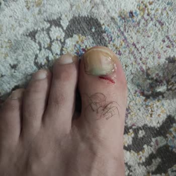 Türkiye'nin ATM Merkezi ATM'de Yaşanan Güvenlik Sorunu Ve Yaralanma Şikayeti