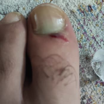 Türkiye'nin ATM Merkezi ATM'de Yaşanan Güvenlik Sorunu Ve Yaralanma Şikayeti