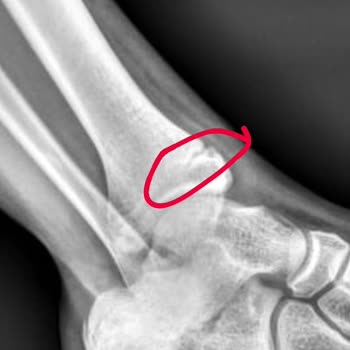 Arnavutköy Devlet Hastanesi Ortopedi Uzmanı Değerlendirmesi