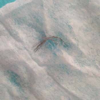 Baby Turco'dan Kuş Tüyü Çıktı!
