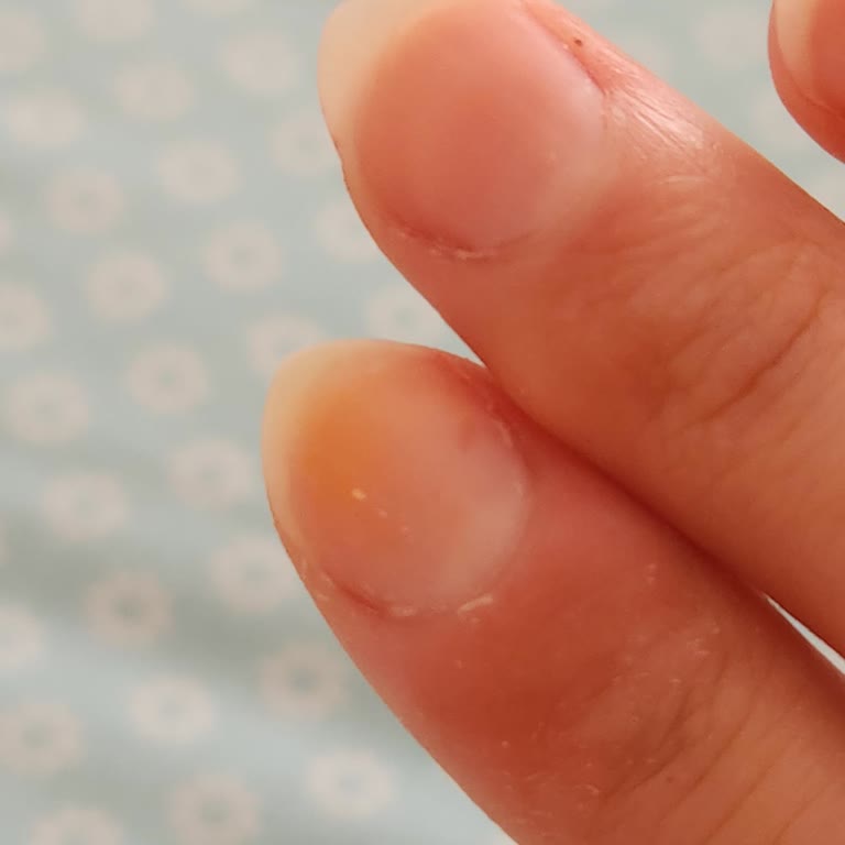 Flormar Kırmızı Oje Tırnak Sararması