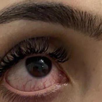 Çisem Estetik Güzellik 'te Kötü İşlem