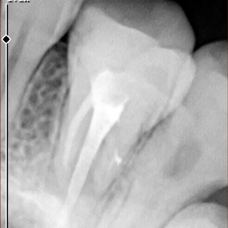 Alanya Baha Sağlık Ağız Ve Diş Sağlığı Merkezi Üç Sinirin Sadece Bir Tanesini Doldurmuş