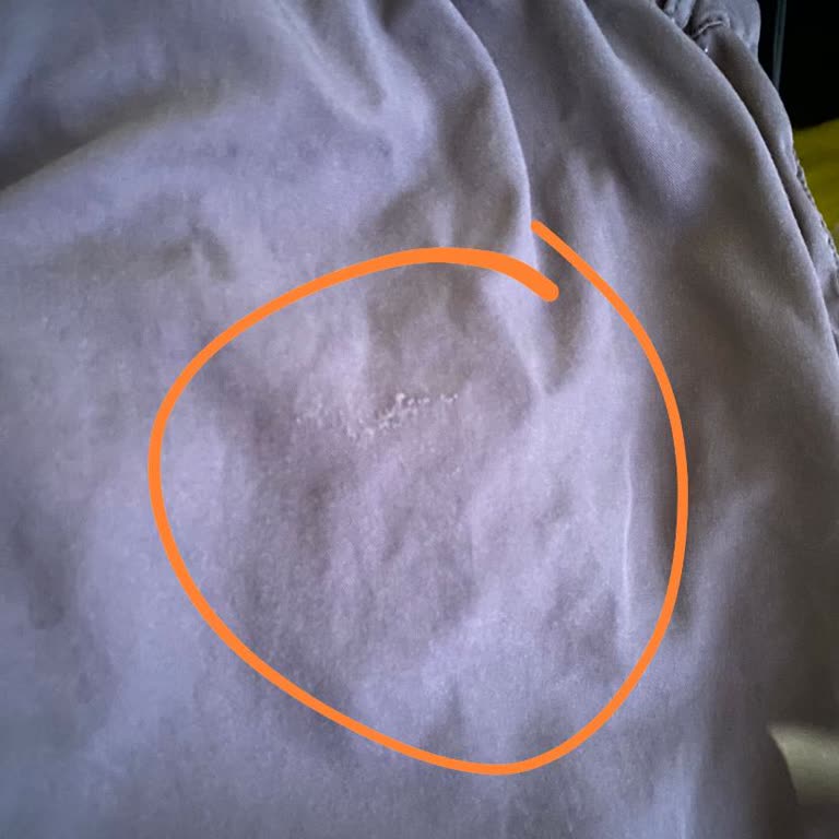 Koton'dan Almış Olduğum Pantolonda Yaşadığım Mağduriyet!