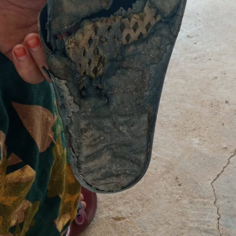 Greyder'den Aldım Ürünün Kullanıcı Hatası